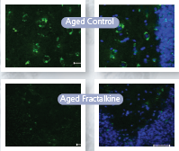 Microglial activation in the aging brain
